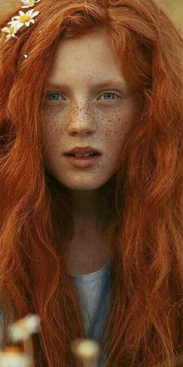 The best hair colour and freckles ever. source: pinterest